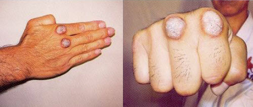Back In The Gi » Blog Archive » Always punch with the first two knuckles to  avoid borking your hand.